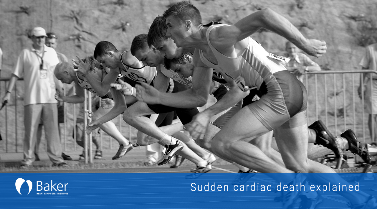 Sudden cardiac death