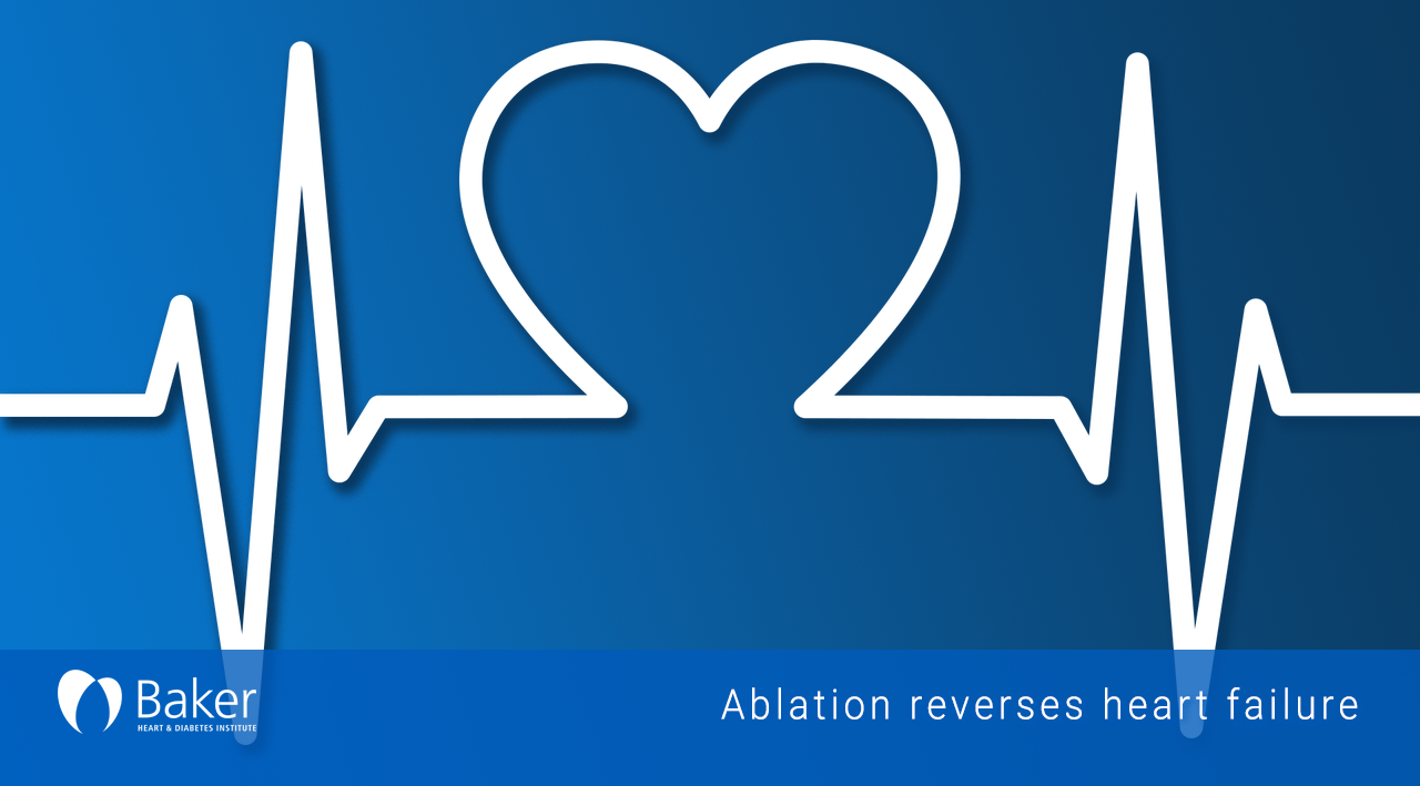 Ablation found to reverse common type of heart failure The National