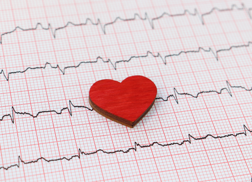 Heart on an ECG heart trace