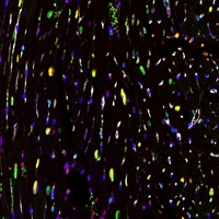 This is an image of Heart cells- different colours represent the diversity of cells in our heart