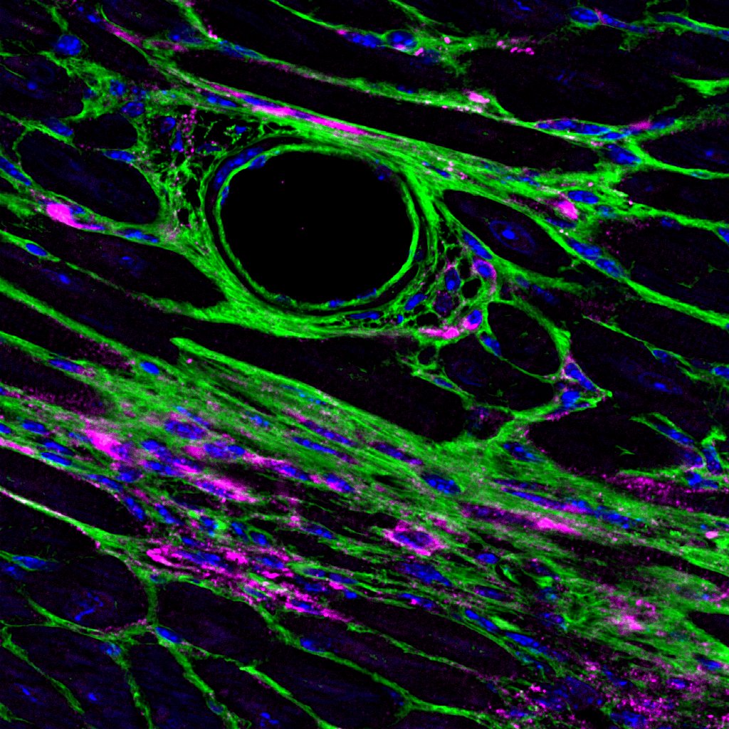 the image show fats cells called adipocytes