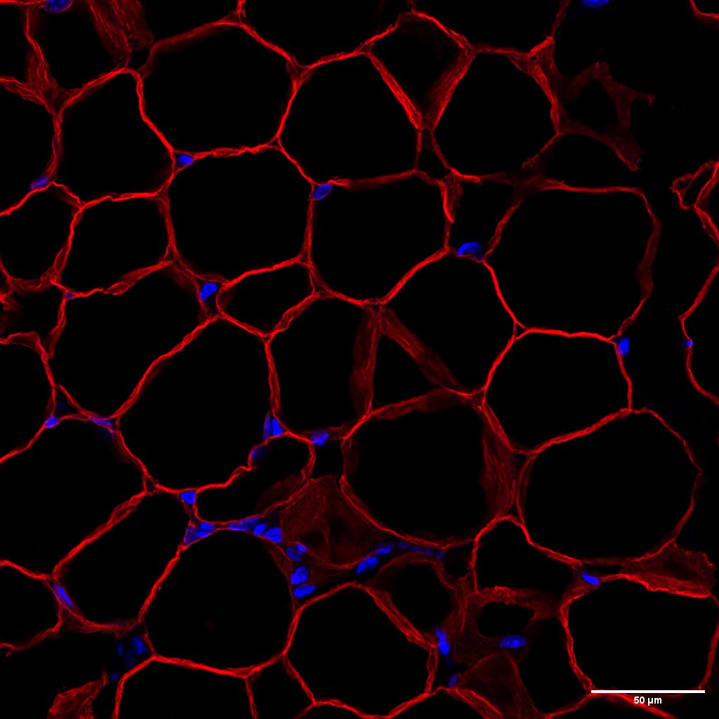 the image show fats cells called adipocytes